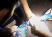 Cincin Titanium Berhasil Dilepas dari Jari Remaja Gerung dalam Operasi Dramatis Damkar Lobar